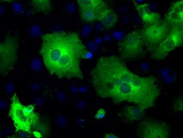 PDE10A Antibody in Immunocytochemistry (ICC/IF)