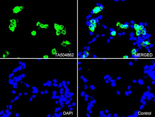 PECAM1 Antibody in Immunocytochemistry (ICC/IF)