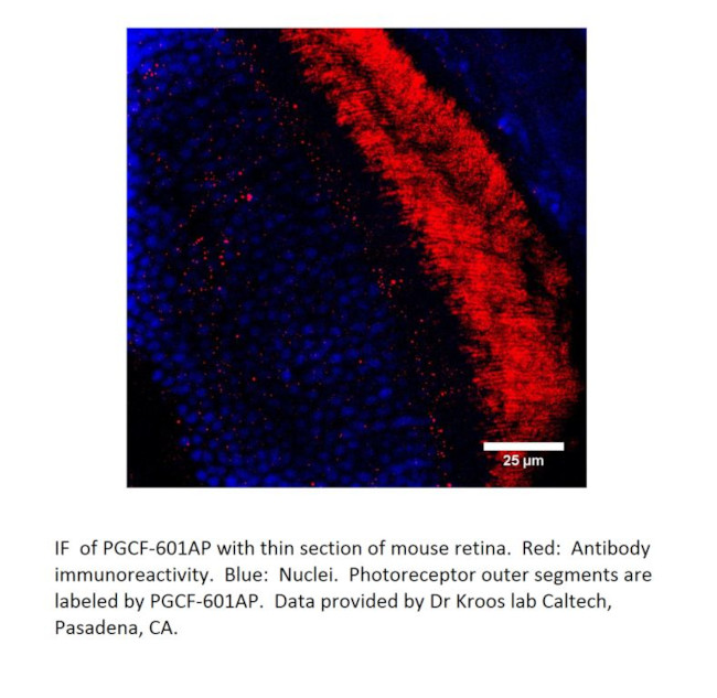 PGCF Antibody in Immunohistochemistry (IHC)