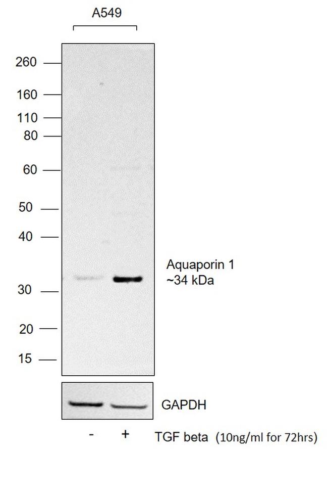 Human TGF-beta 1 Recombinant Protein (PHG9214)