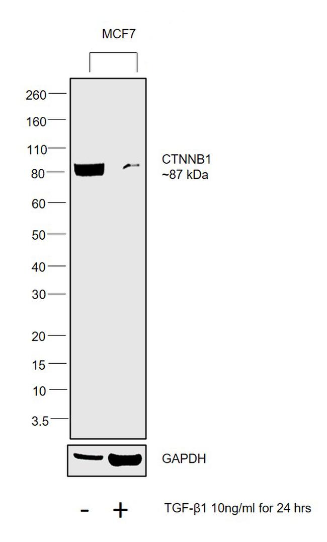 Human TGF-beta 1 Recombinant Protein (PHG9214)