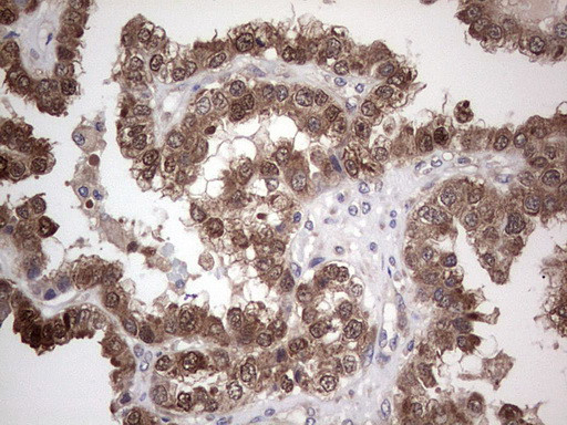 PIK3CA Antibody in Immunohistochemistry (Paraffin) (IHC (P))