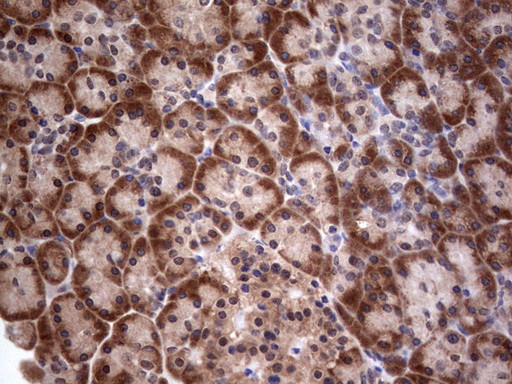 PIK3CA Antibody in Immunohistochemistry (Paraffin) (IHC (P))