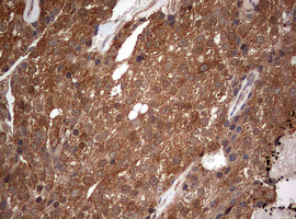 PIK3CA Antibody in Immunohistochemistry (Paraffin) (IHC (P))