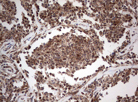 PIK3CA Antibody in Immunohistochemistry (Paraffin) (IHC (P))