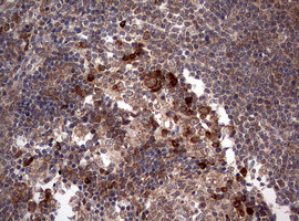 PIK3CA Antibody in Immunohistochemistry (Paraffin) (IHC (P))