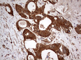 PIK3CA Antibody in Immunohistochemistry (Paraffin) (IHC (P))