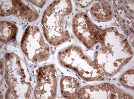 PIK3CA Antibody in Immunohistochemistry (Paraffin) (IHC (P))