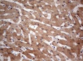 PIK3CA Antibody in Immunohistochemistry (Paraffin) (IHC (P))