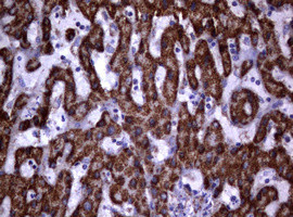 PIK3CD Antibody in Immunohistochemistry (Paraffin) (IHC (P))