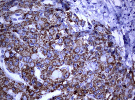 PIK3CD Antibody in Immunohistochemistry (Paraffin) (IHC (P))