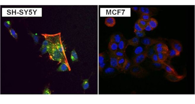 PKC alpha Antibody in Immunocytochemistry (ICC/IF)