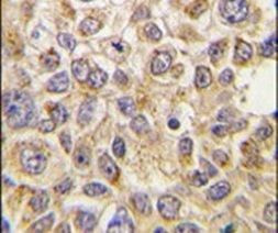 PMAT Antibody in Immunohistochemistry (IHC)