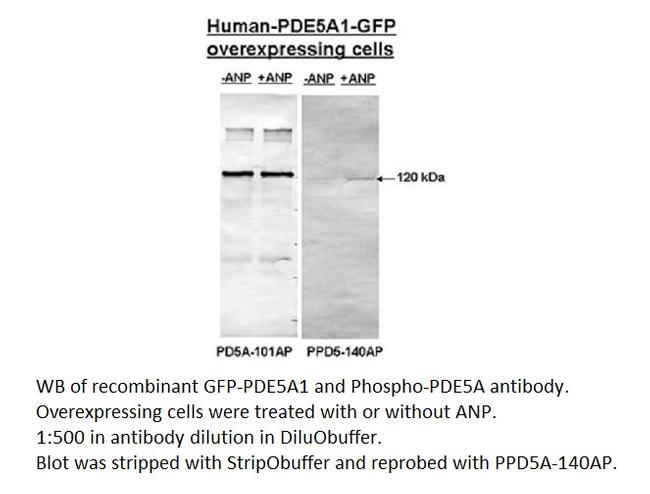 Phospho-PDE5A (Thr16) Antibody in Western Blot (WB)