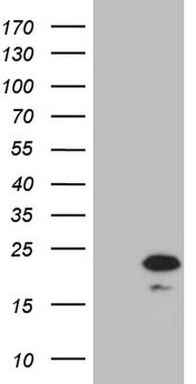 PPIF Antibody in Western Blot (WB)