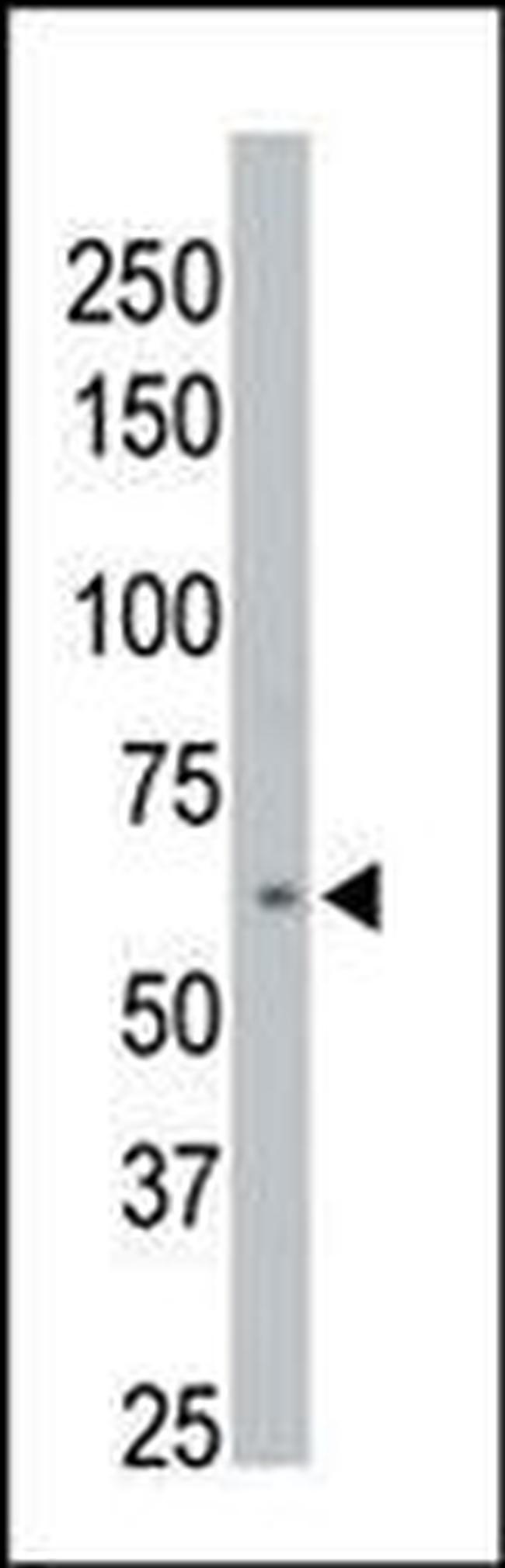 PPM1D Antibody in Western Blot (WB)