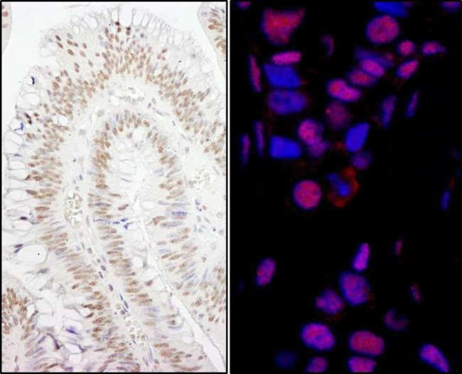 PPP4R3 Alpha Antibody in Immunohistochemistry (IHC)