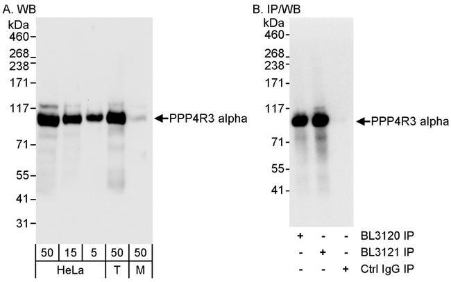 PPP4R3 Alpha Antibody in Western Blot (WB)