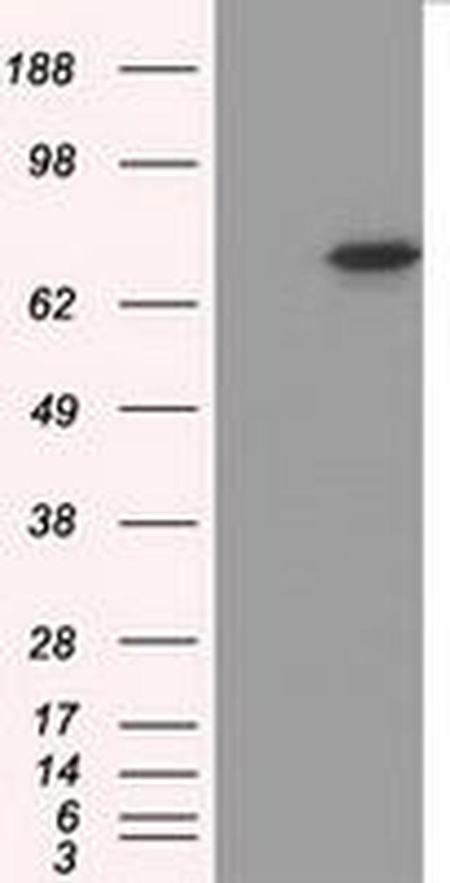 PRKG1 Antibody in Western Blot (WB)