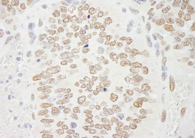 PRMT6 Antibody in Immunohistochemistry (IHC)