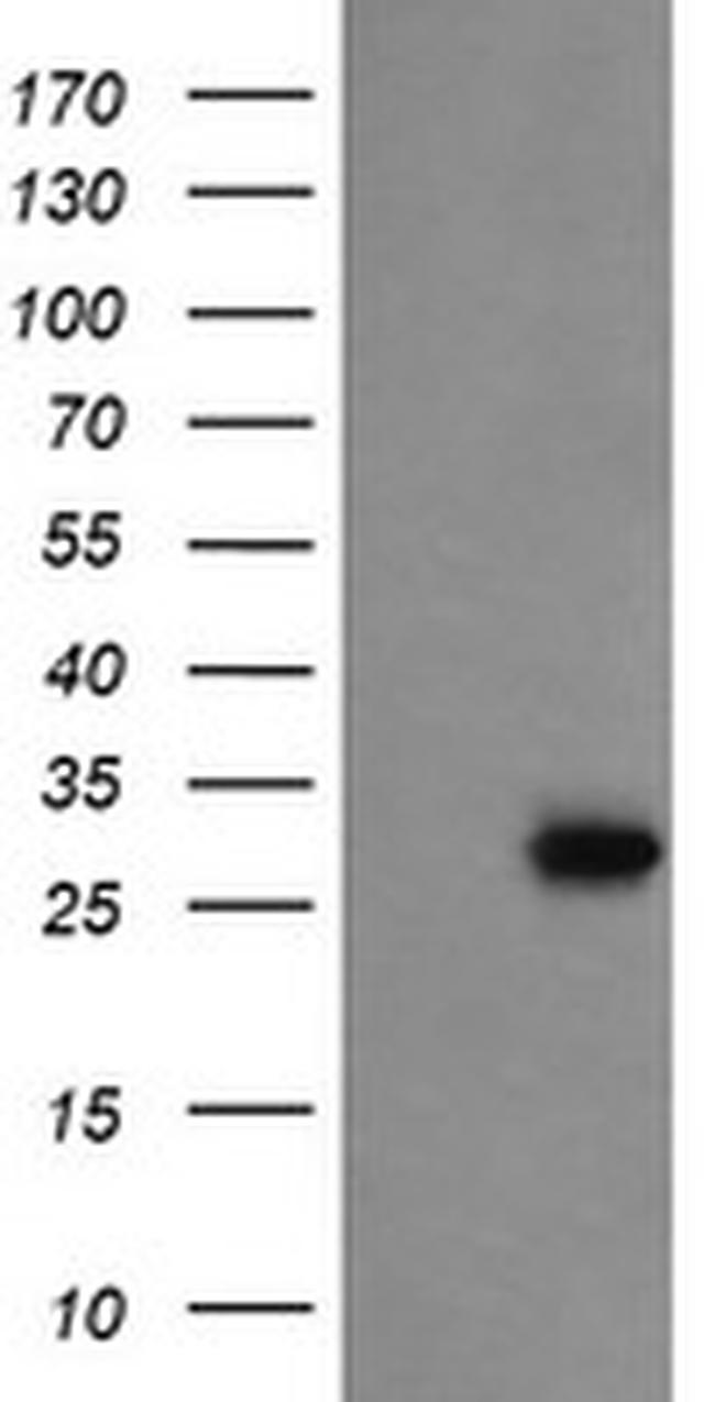 PROSC Antibody in Western Blot (WB)