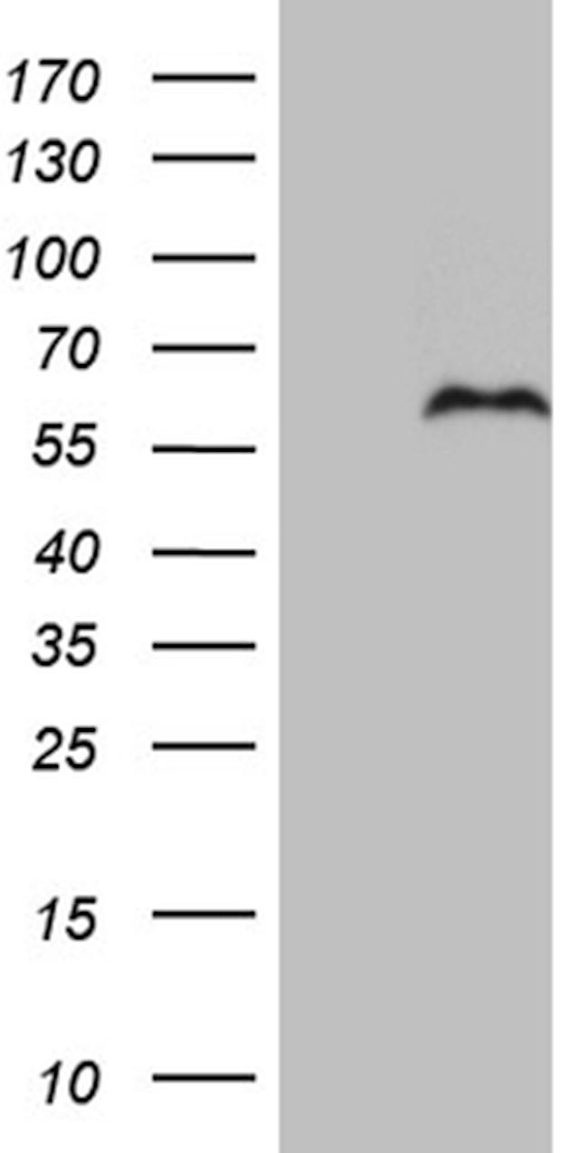 PRRT2 Antibody in Western Blot (WB)