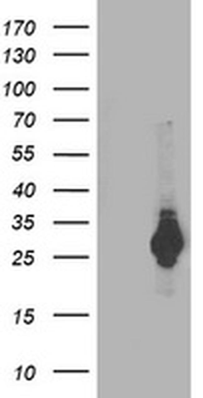 PSMB4 Antibody in Western Blot (WB)