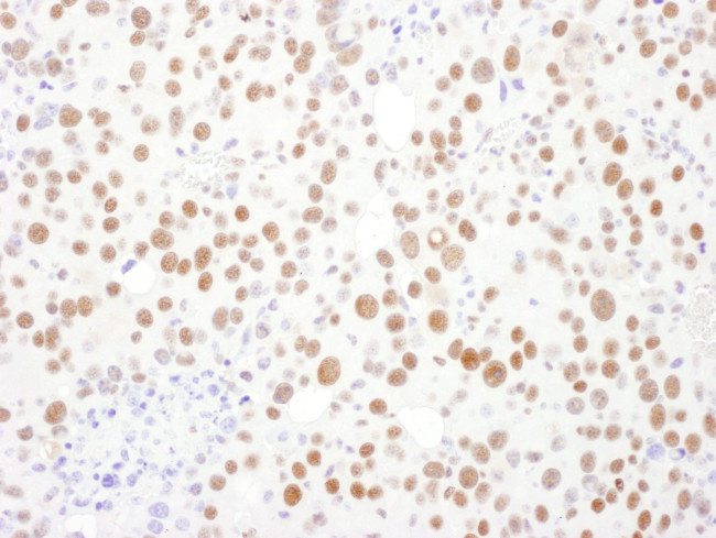 PSME3 Antibody in Immunohistochemistry (IHC)