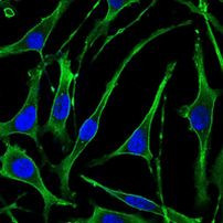 PTH1R Antibody in Immunocytochemistry (ICC/IF)