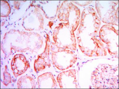 PTH1R Antibody in Immunohistochemistry (Paraffin) (IHC (P))