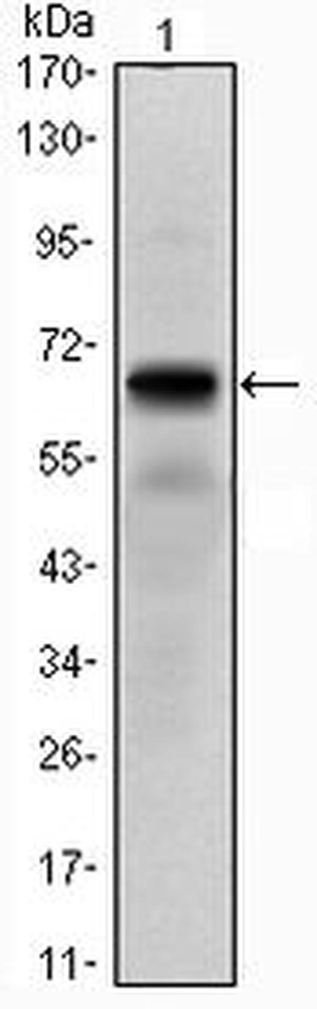 PTH1R Antibody in Western Blot (WB)