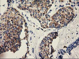 PYCR2 Antibody in Immunohistochemistry (Paraffin) (IHC (P))