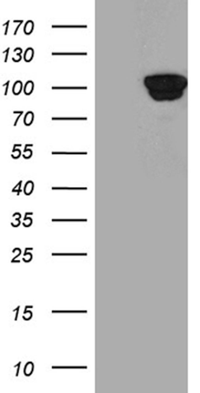 PYGM Antibody in Western Blot (WB)