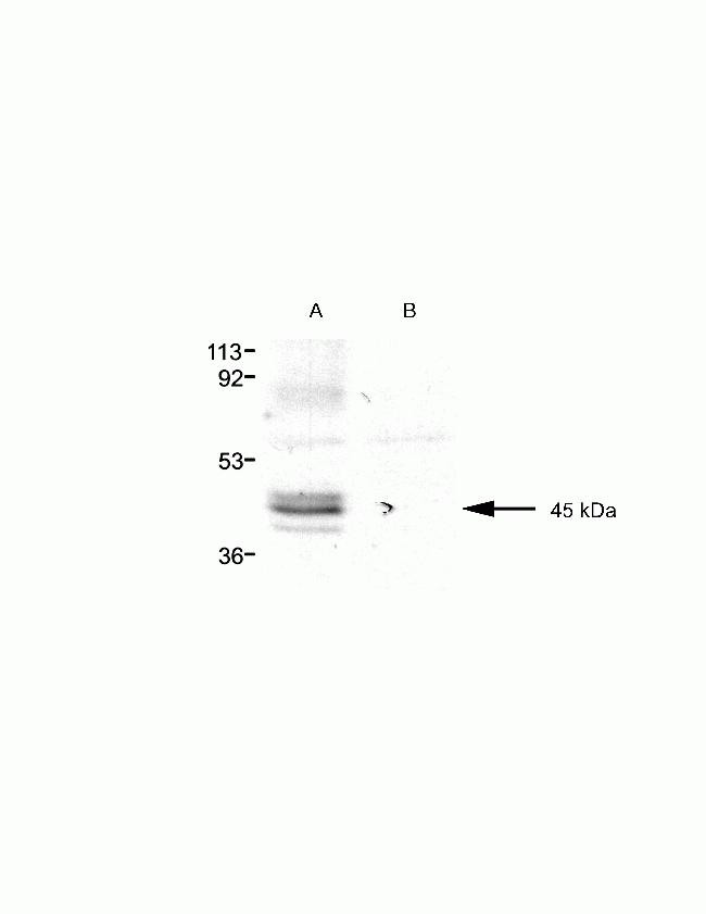 Pannexin 3 Antibody in Western Blot (WB)