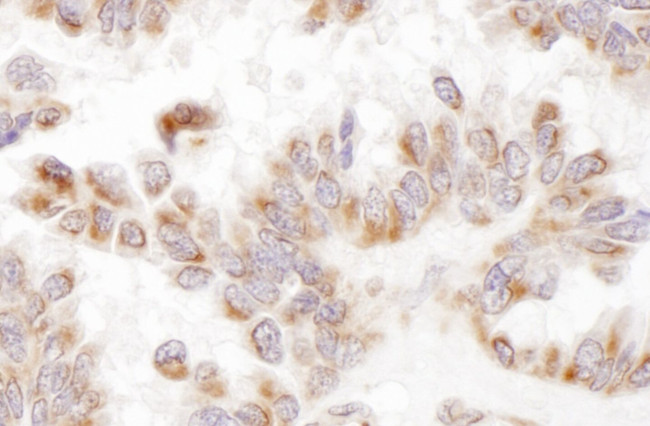 Presenilin-2 Antibody in Immunohistochemistry (IHC)