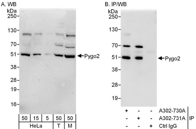Pygo2 Antibody in Western Blot (WB)
