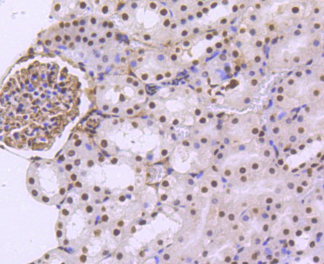 TRIM28 Antibody in Immunohistochemistry (Paraffin) (IHC (P))
