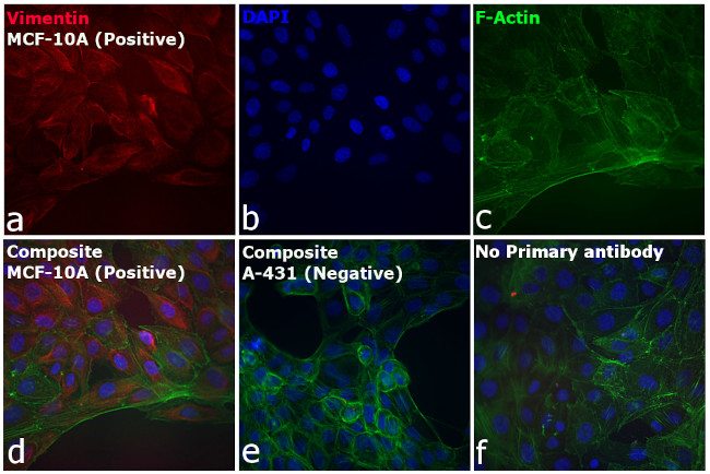 Rabbit IgG (H+L) Secondary Antibody in Immunocytochemistry (ICC/IF)