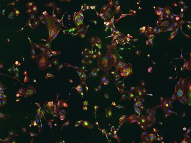 Mouse IgG (H+L) Cross-Adsorbed Secondary Antibody in Immunocytochemistry (ICC/IF)