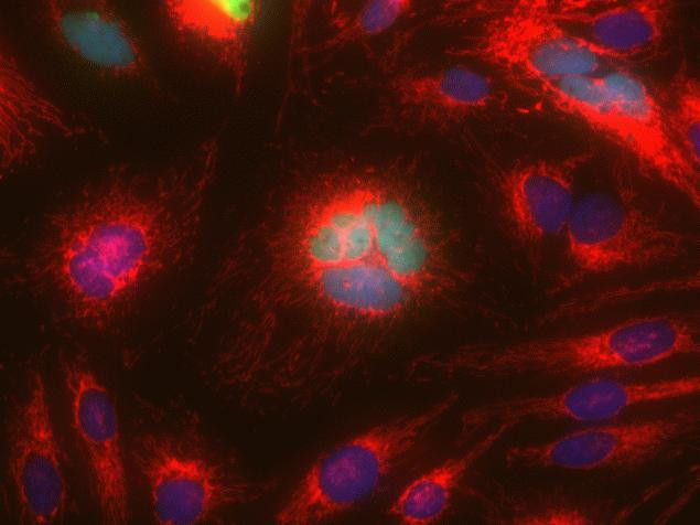 Mouse IgG (H+L) Cross-Adsorbed Secondary Antibody in Immunocytochemistry (ICC/IF)