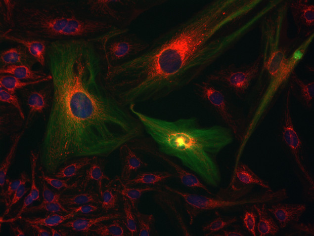 Mouse IgG (H+L) Cross-Adsorbed Secondary Antibody in Immunocytochemistry (ICC/IF)