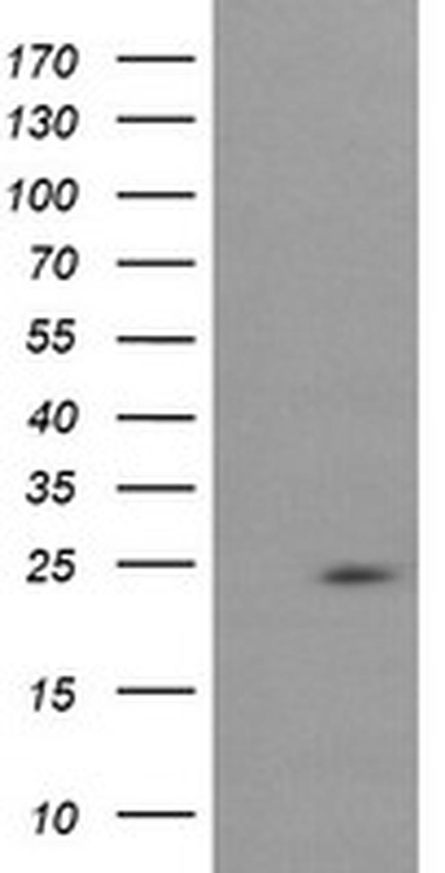 RAB37 Antibody in Western Blot (WB)