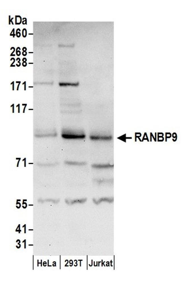 RANBP9 Antibody in Western Blot (WB)