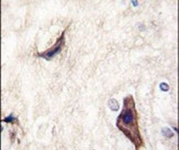 RASGRF1 Antibody in Immunohistochemistry (IHC)