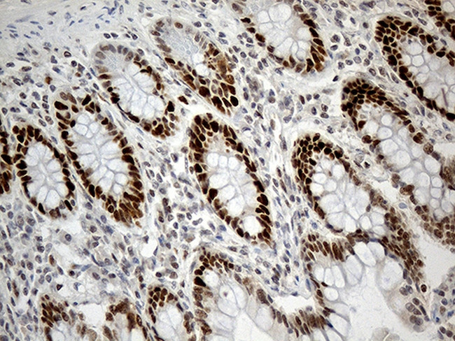 RB1 Antibody in Immunohistochemistry (Paraffin) (IHC (P))