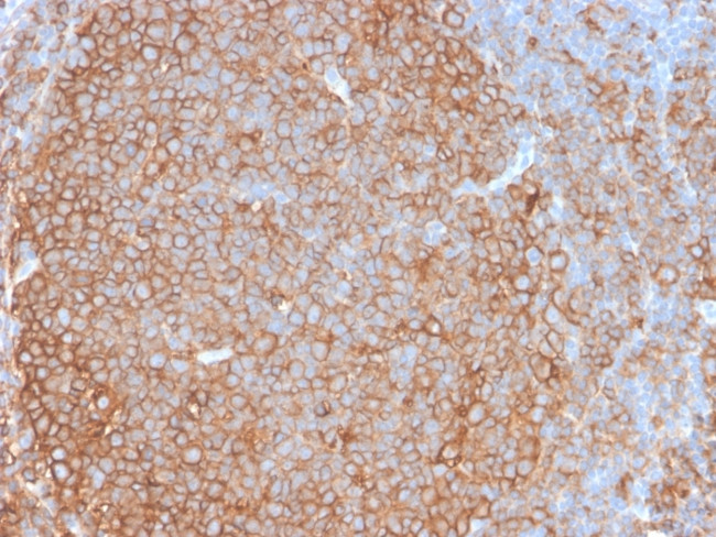 HLA-Pan (MHC II) Antibody in Immunohistochemistry (Paraffin) (IHC (P))
