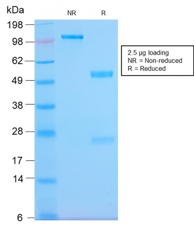 HLA-Pan (MHC II) Antibody in SDS-PAGE (SDS-PAGE)