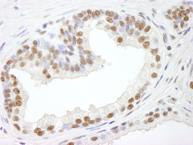 RBM25/RED120 Antibody in Immunohistochemistry (IHC)