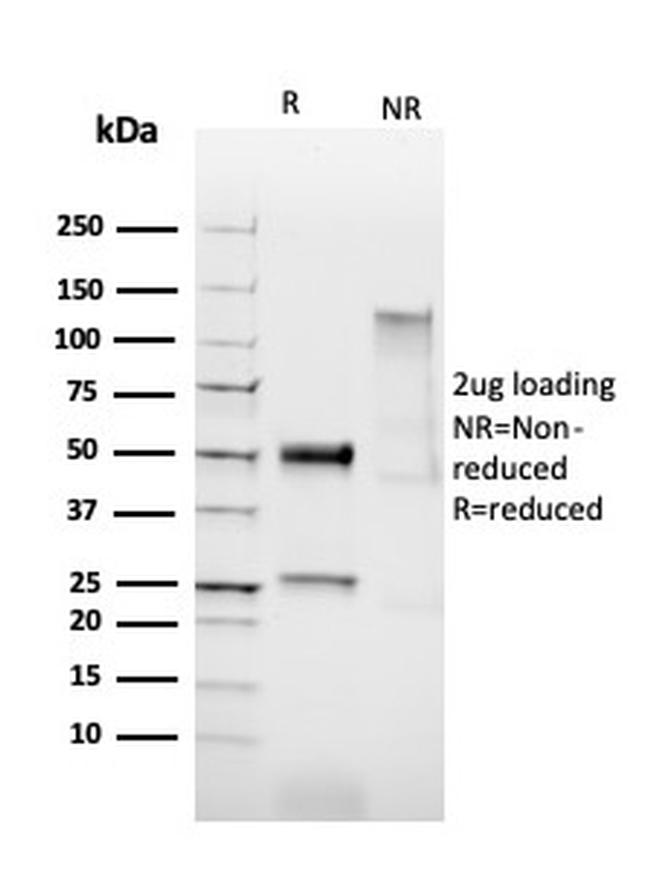 HPV-16 (Human Papilloma Virus 16) Antibody in SDS-PAGE (SDS-PAGE)