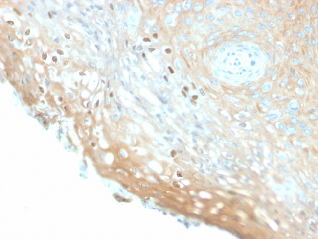 HPV-16 (Human Papilloma Virus 16) Antibody in Immunohistochemistry (Paraffin) (IHC (P))